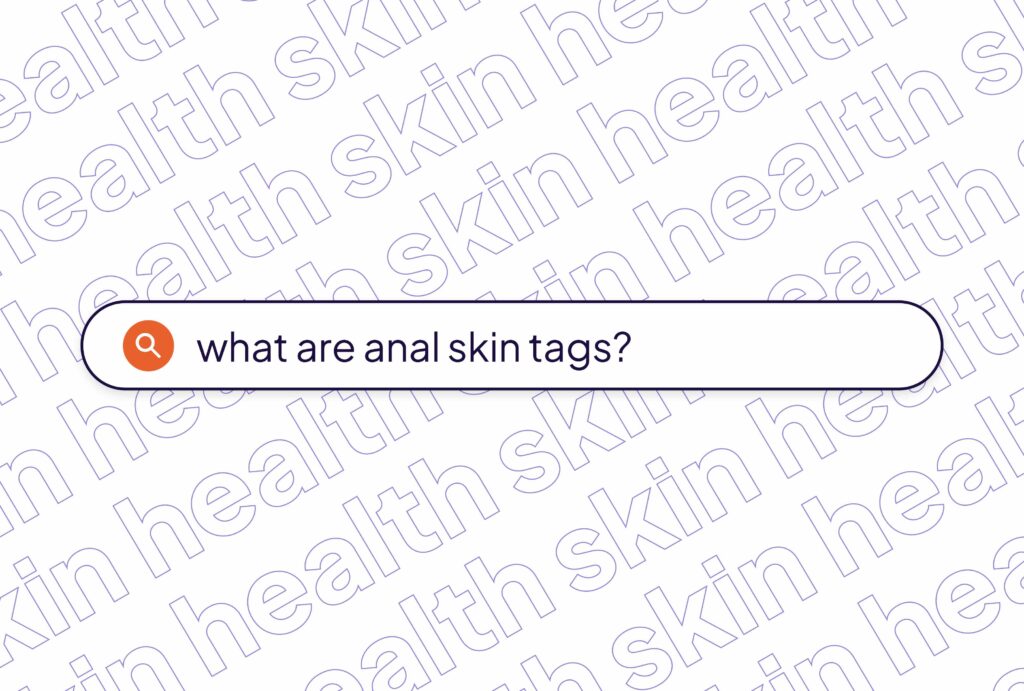 Causes, Treatment and Removal, and More