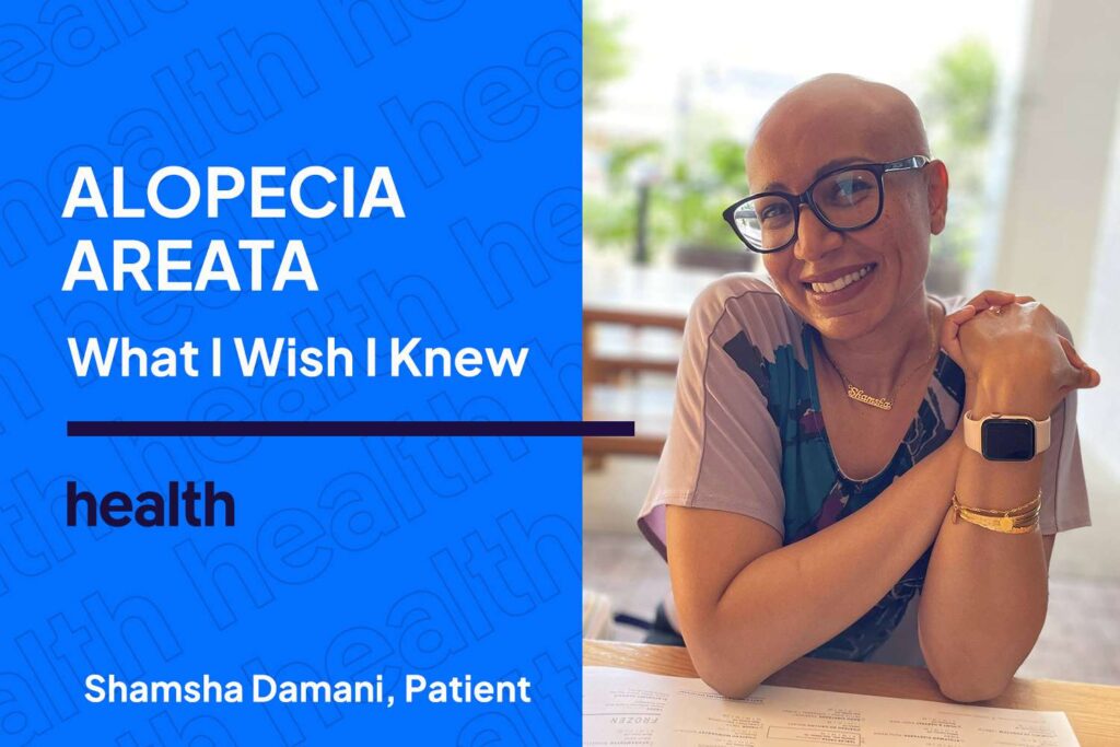 Finding an Alopecia Areata Community