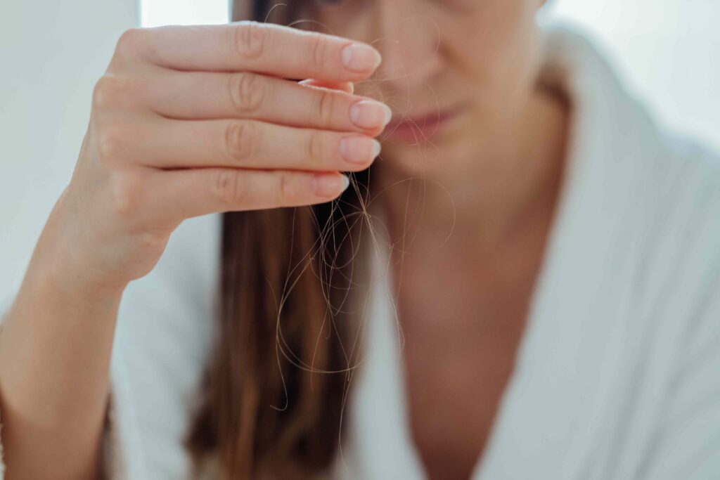 How To Stop Alopecia Areata From Spreading