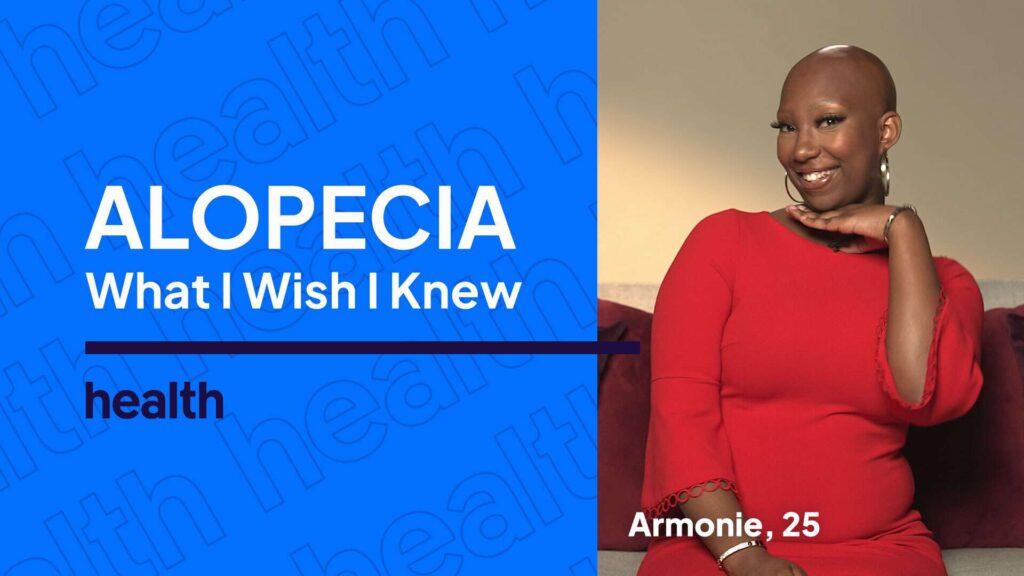 What I Wish I Knew About Alopecia