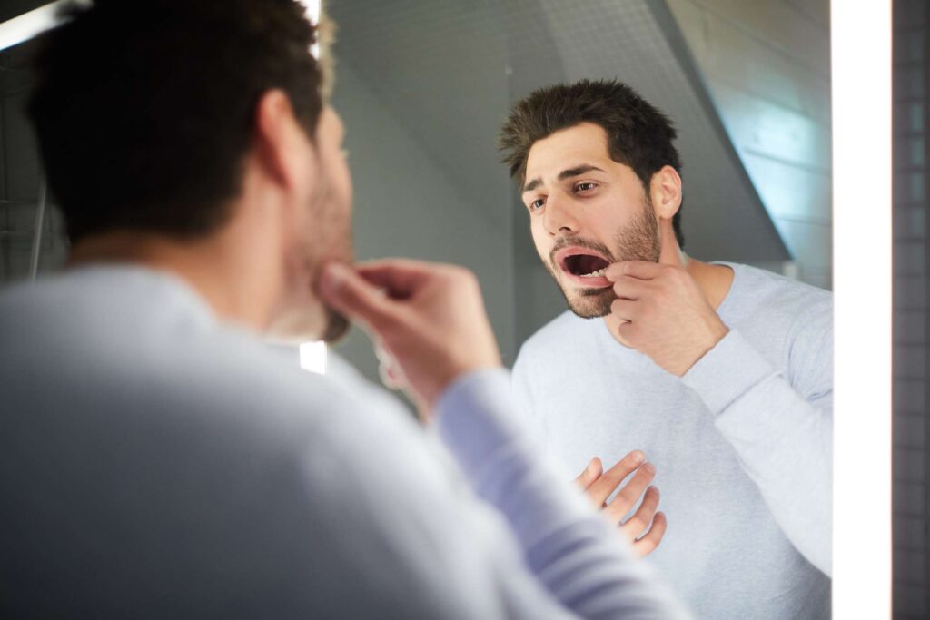 Common Tongue Conditions in People With HIV