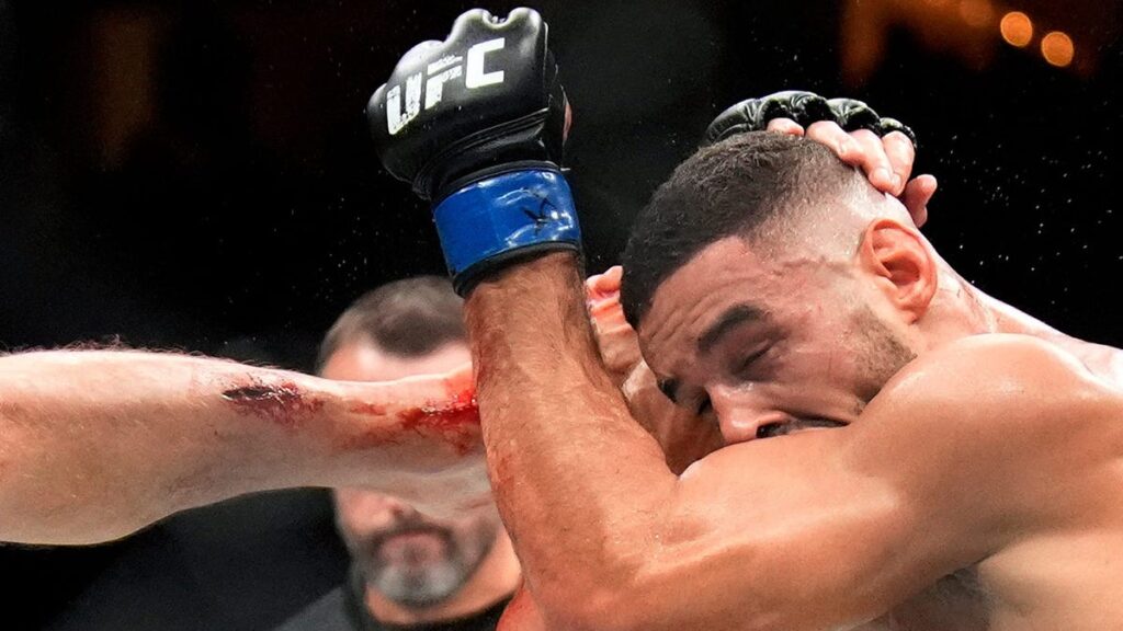 Stephen Thompson split shin to the bone in loss