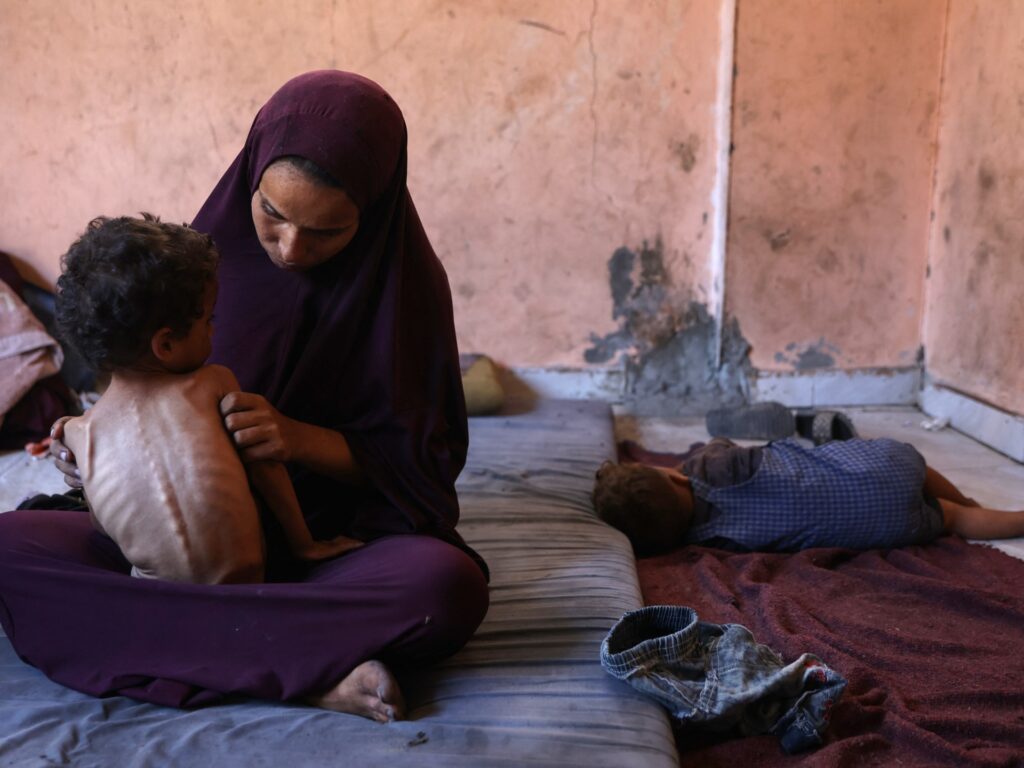Amid Gaza famine, Palestinian girl struggles to survive | Gaza News
