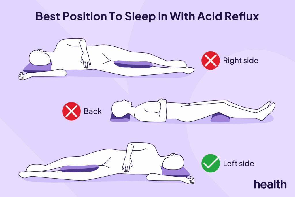 What Sleeping on Your Left Side Does for Heartburn Relief